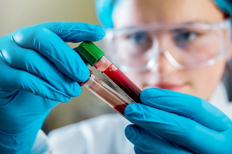 Hepatitis С