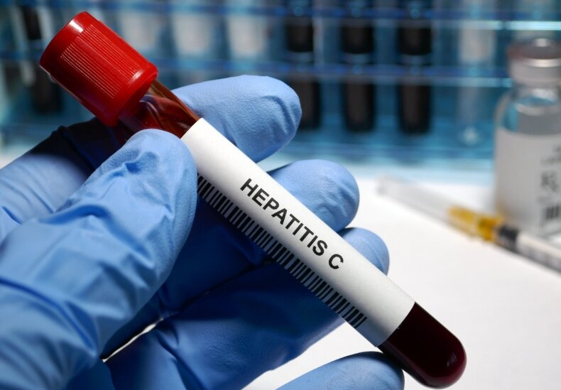 Hepatitis С