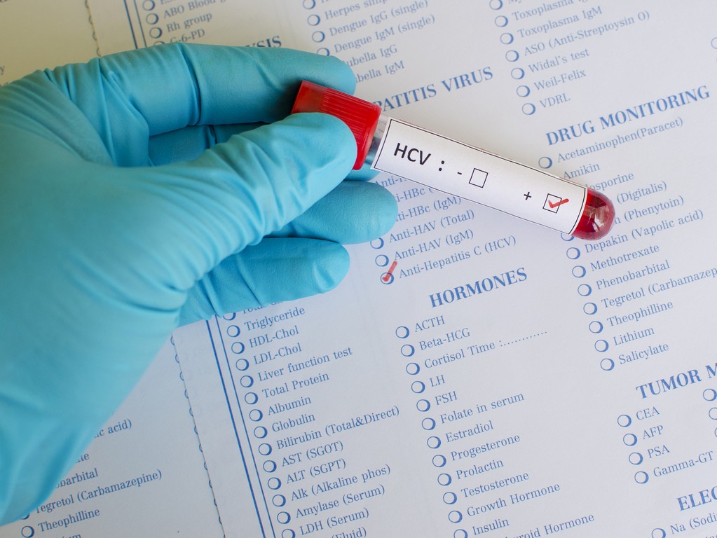 Sofosbuvir в Люберцах