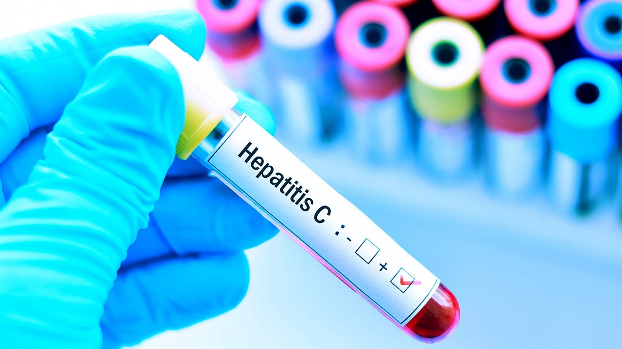 Hepatitis С