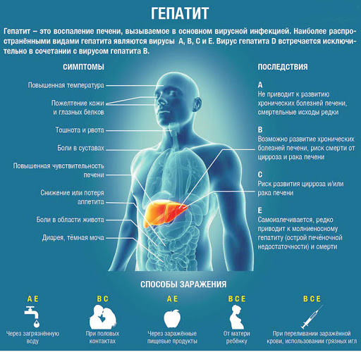 Sofosbuvir в Калининграде
