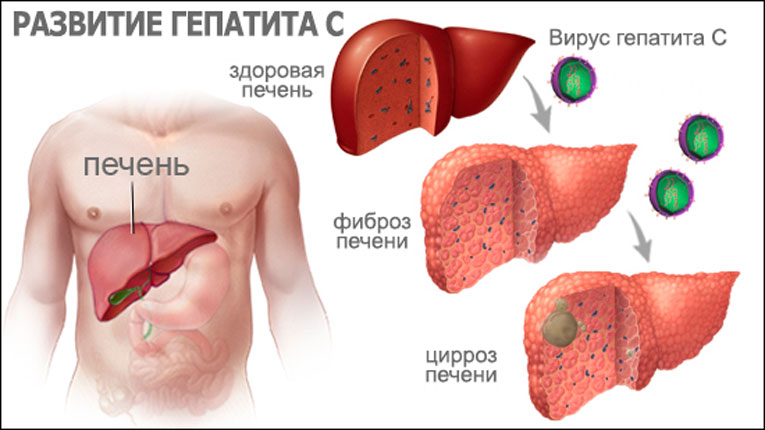 Daclatasvir в Калининграде