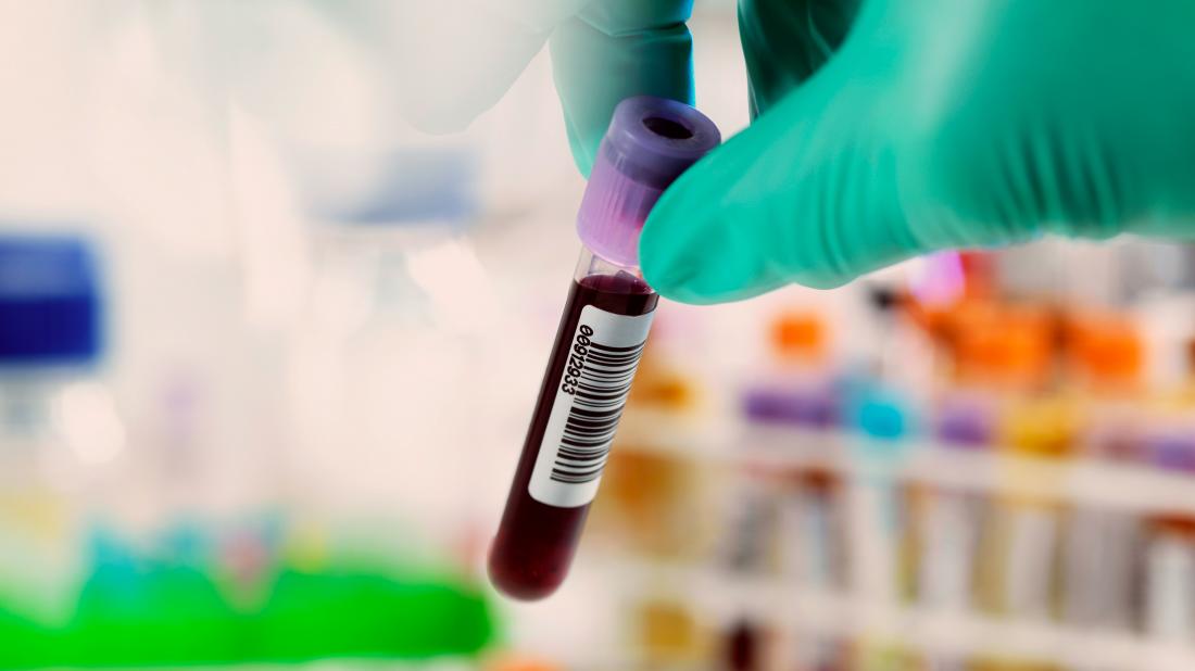 Hepatitis С