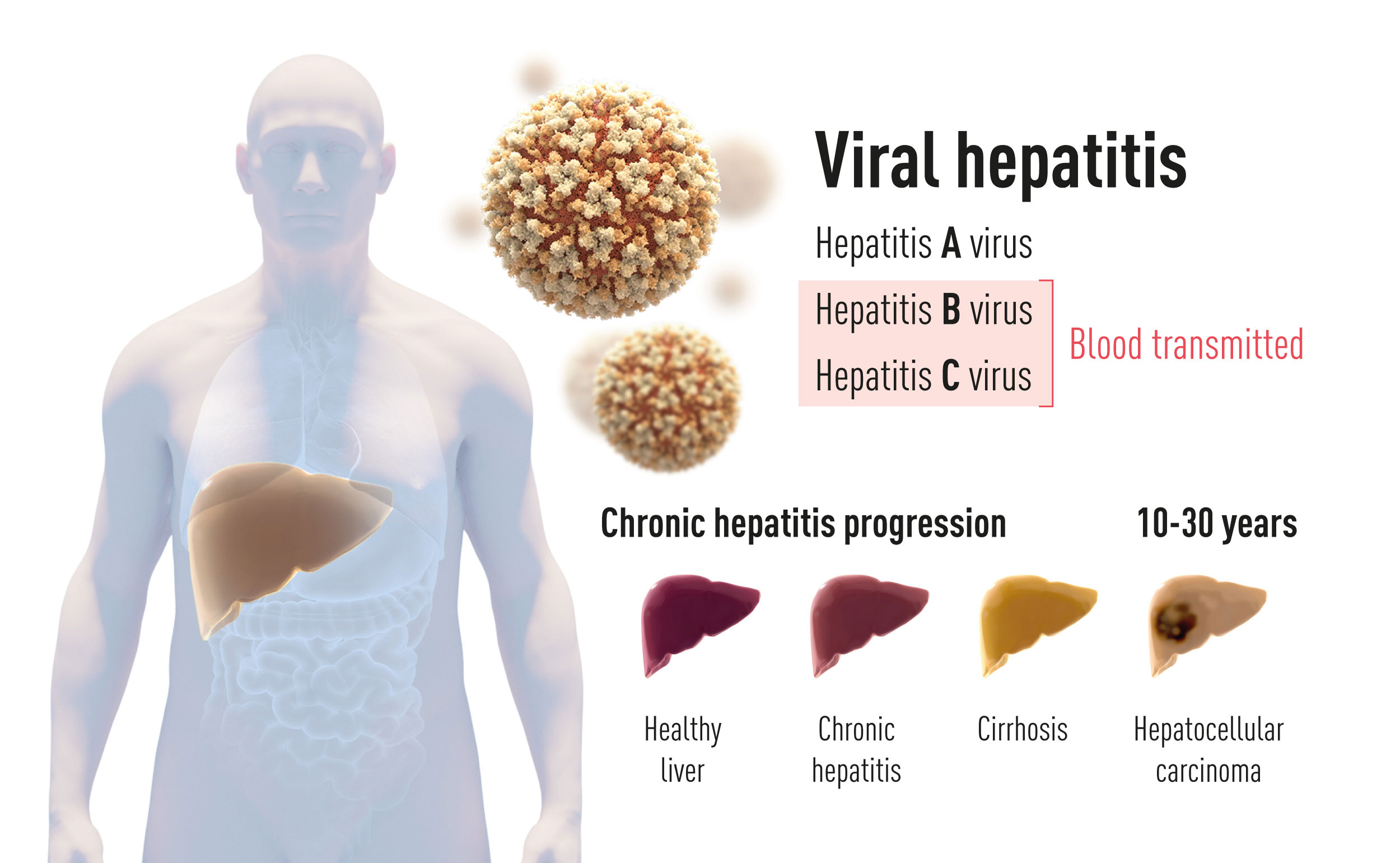 Hepatitis С